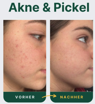 LED light therapy mask 3 colors